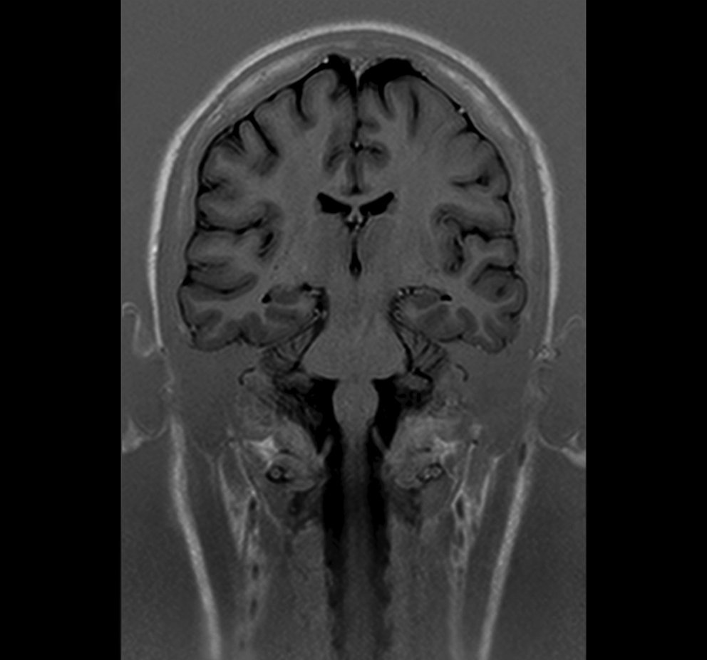 Brain MRI - Image by AIM Medical Imaging